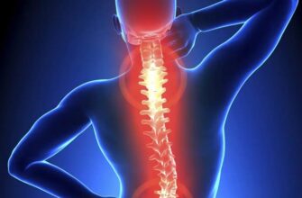 Остеохондроз - симптомы и методы лечения